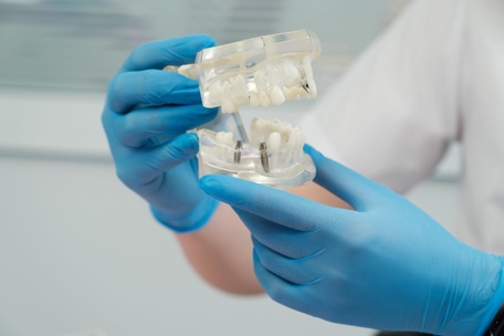 ИМПЛАНТАЦИЯ ЗУБОВ МОЖЕТ БЫТЬ ДОСТУПНА КАЖДОМУ